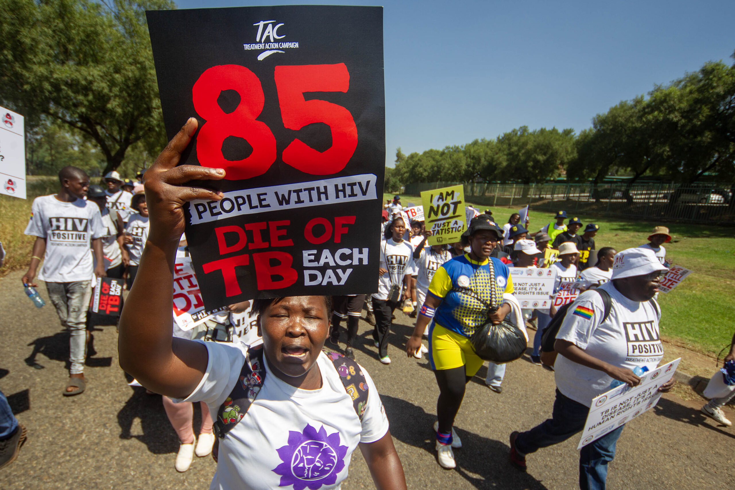 We Still Die of AIDS & TB!
